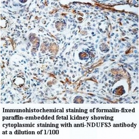 NDUFS3 Antibody