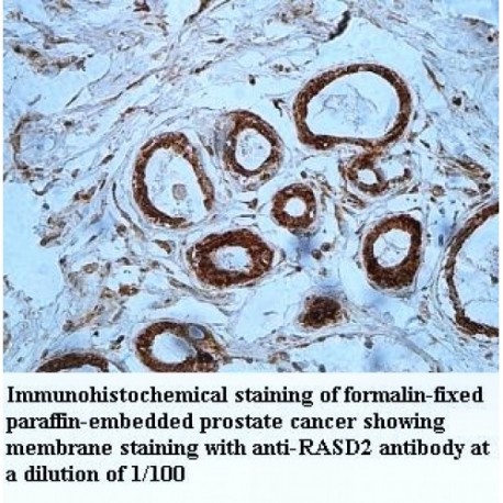 RASD2 Antibody