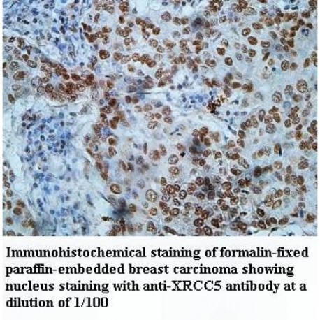 XRCC5 Antibody