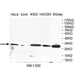 UBE2G1 Antibody