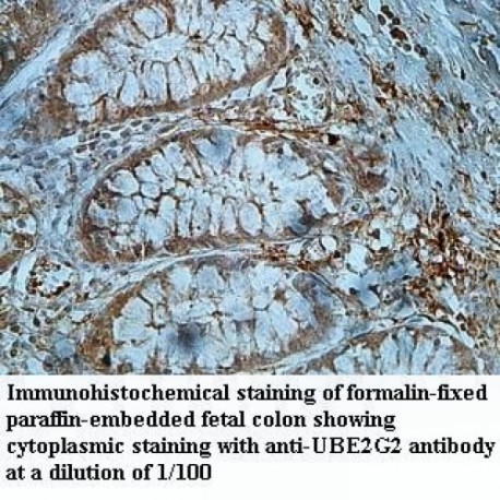 UBE2G2 Antibody