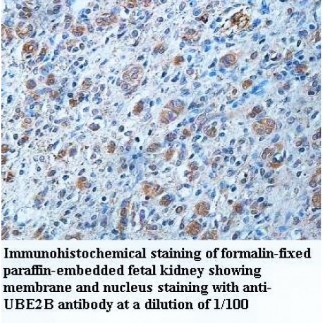 UBE2B Antibody