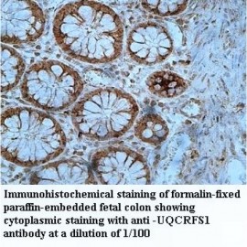 UQCRFS1 Antibody