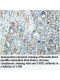 URB2 Antibody