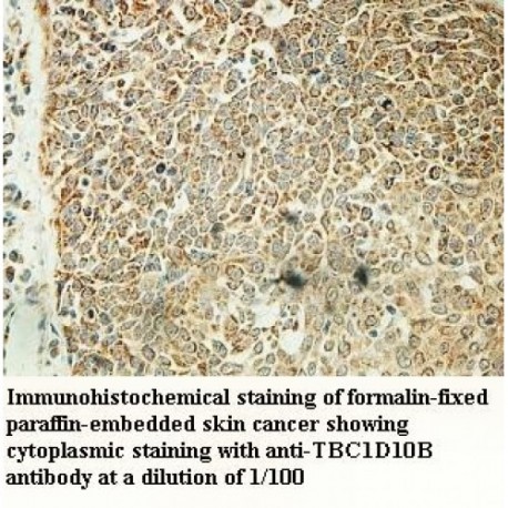 TBC1D10B Antibody