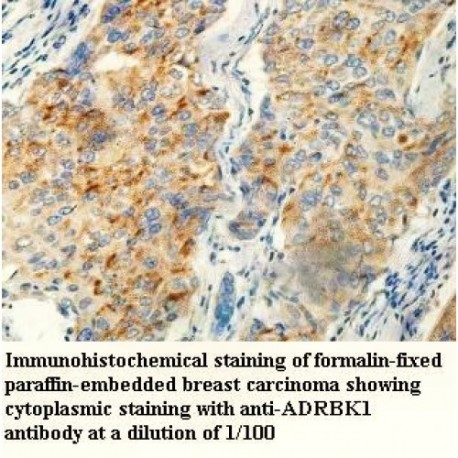 ADRBK1 Antibody