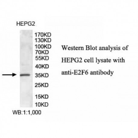 E2F6 Antibody