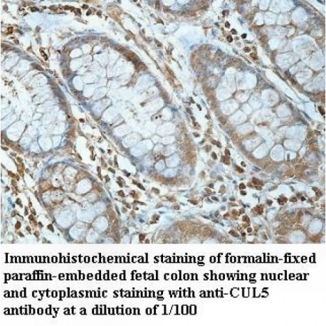 CUL5 Antibody