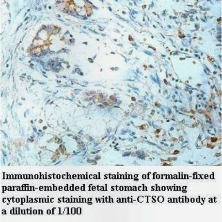 CTSO Antibody