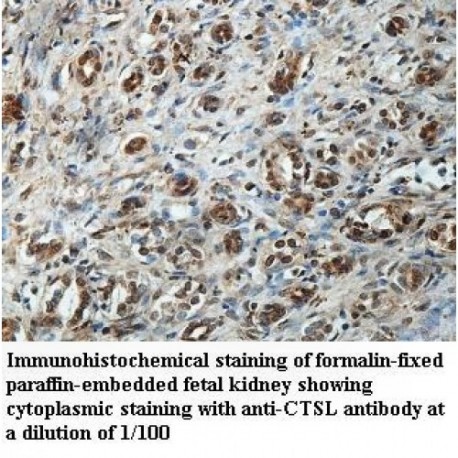 CTSL Antibody