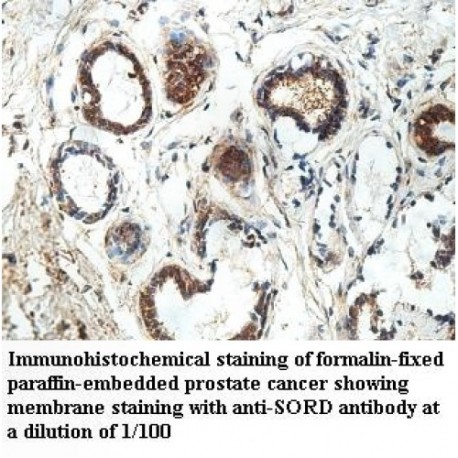 SORD Antibody