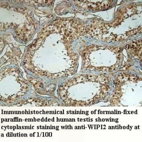 WIPI2 Antibody