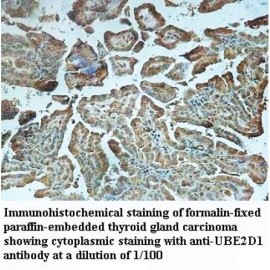 UBE2D1 Antibody