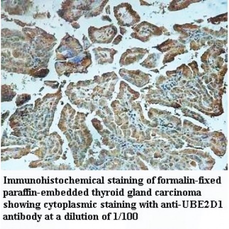 UBE2D1 Antibody