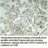 UBE2F Antibody