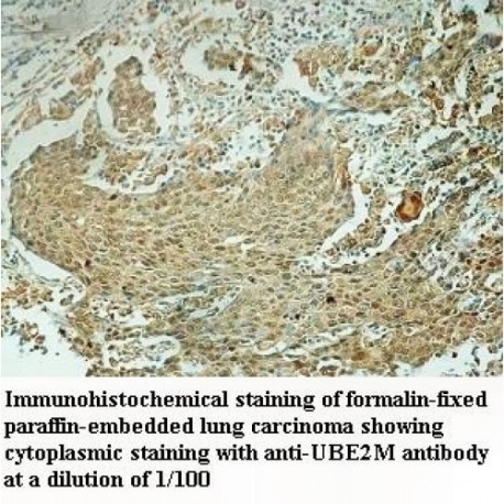 UBE2M Antibody