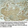 UBE2M Antibody