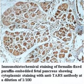 TARS Antibody