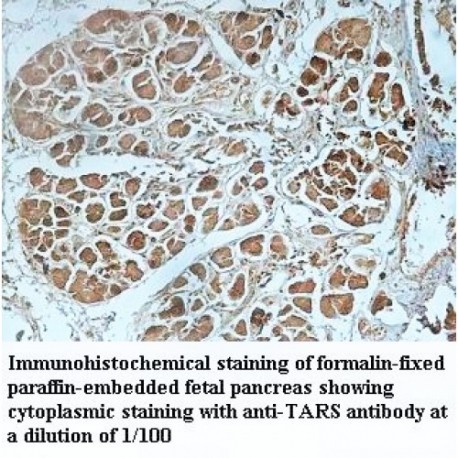 TARS Antibody