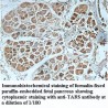 TARS Antibody