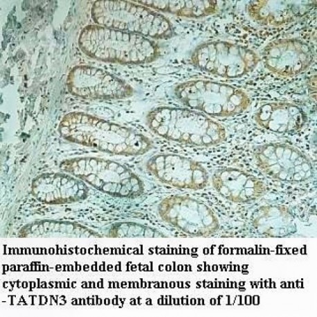 TATDN3 Antibody