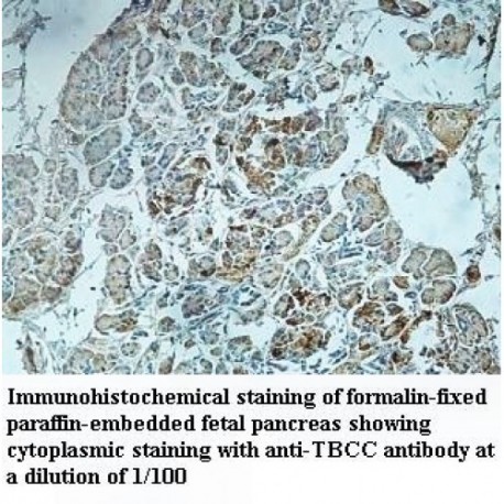 TBCC Antibody