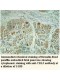 TBL2 Antibody