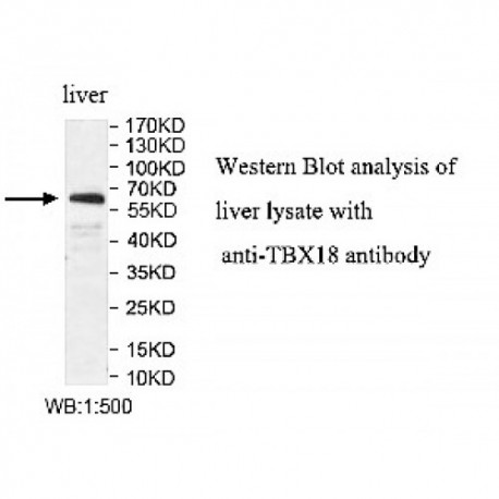 TBX18 Antibody