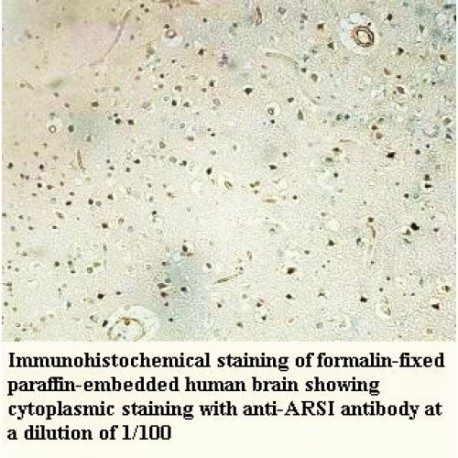 ARSI Antibody