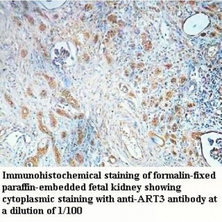 ART3 Antibody