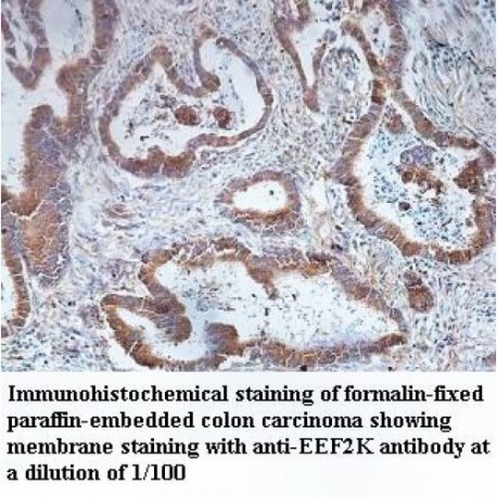 EEF2K Antibody