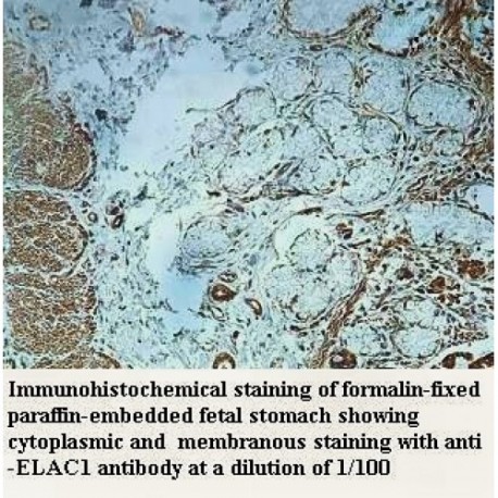 ELAC1 Antibody