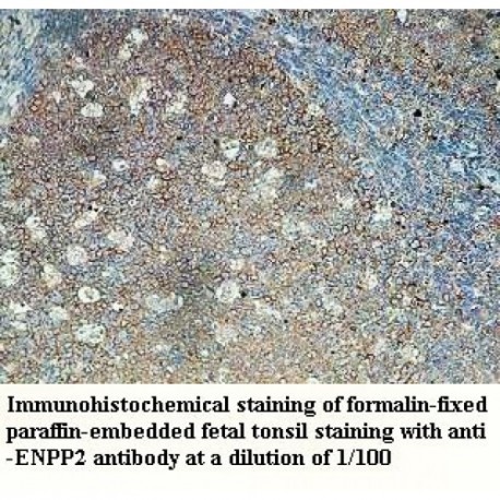 ENPP2 Antibody