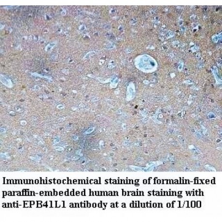 EPB41L1 Antibody