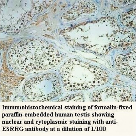 ESRRG Antibody