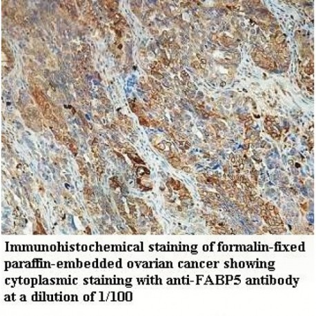 FABP5 Antibody