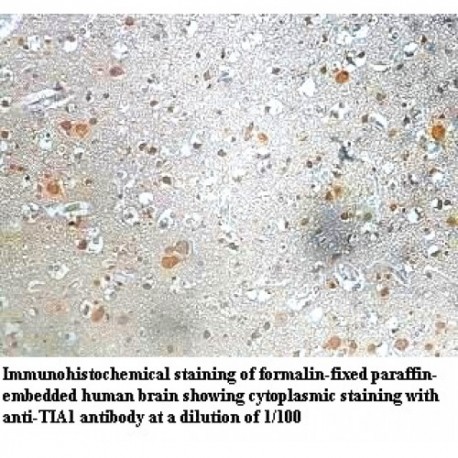 TIA1 Antibody