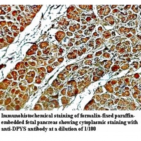 DYPS Antibody