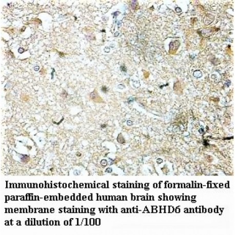 ABHD6 Antibody