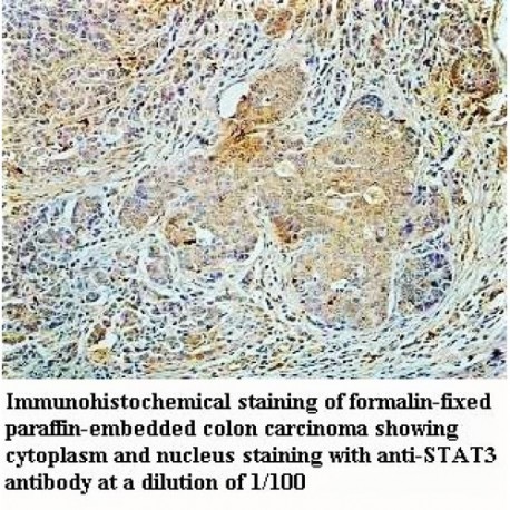 STAT3 Antibody