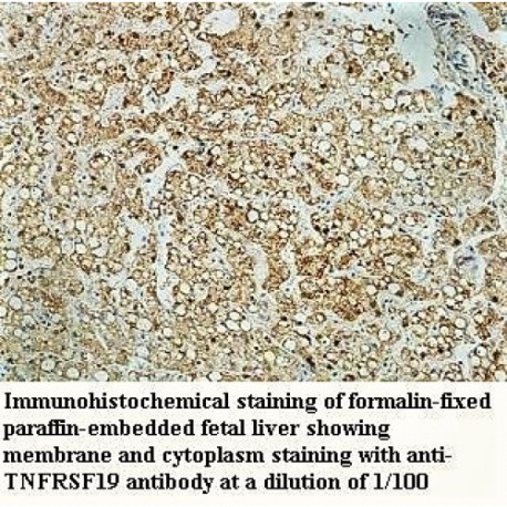 TNFRSF19 Antibody