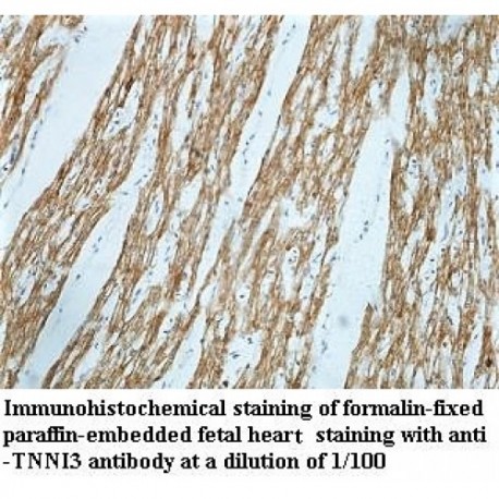 TNNI3 Antibody