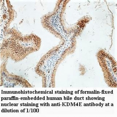 KDM4E Antibody