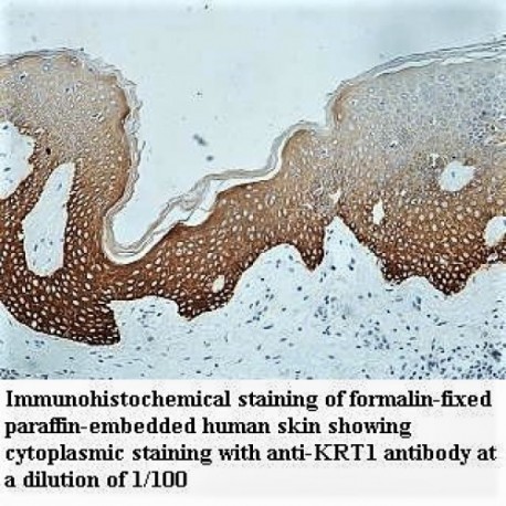 KRT1 Antibody