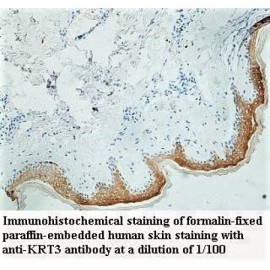 KRT3 Antibody