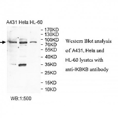 IKBKB Antibody