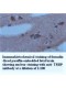 TRBP Antibody