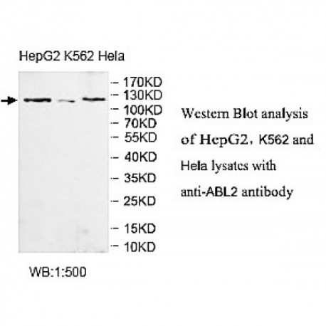 ABL2 Antibody