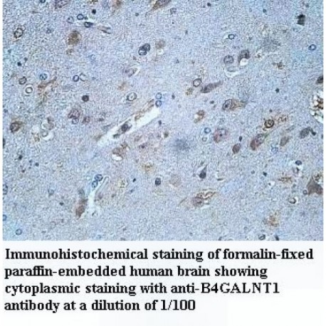 B4GALNT1 Antibody