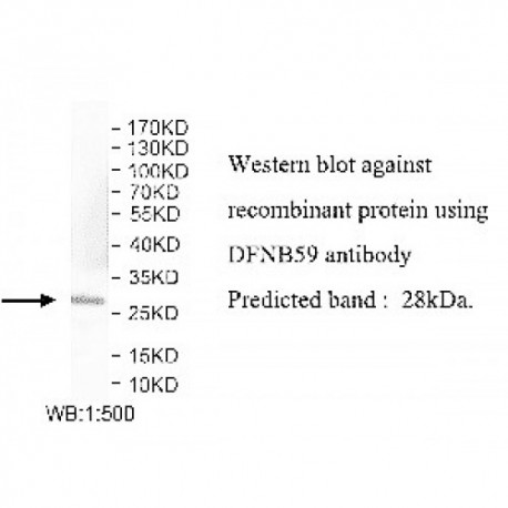 DFNB59 Antibody